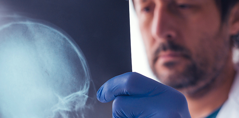What’s the Value of a NYC Brain Injury Claim?
